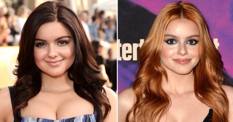 Celebs Who Admitted They Got Plastic Surgery