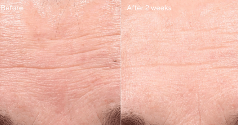 This Anti-Aging Serum Is Producing Amazing Results After Just 2 Weeks