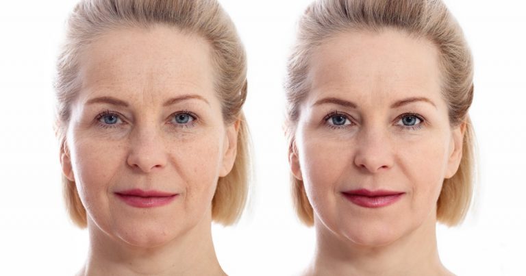 Shoppers Say This ‘Face Lift’ Cream May Help Pause the Aging Process