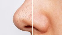 blackheads-before-after-mario-badescu-silver-powder