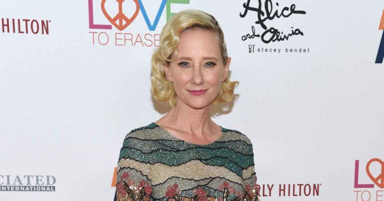 Anne Heche’s Cause of Death Officially Confirmed by Coroner