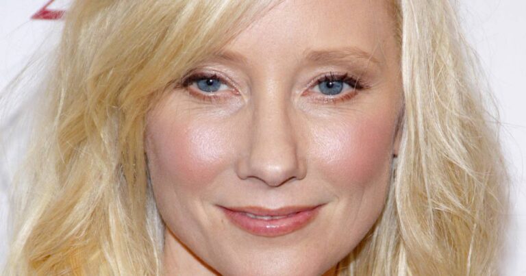 Anne Heche Hospitalized After Suffering Burns in Car Crash Fire: Report